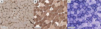 Physiological Effects of Intermittent Passive Exposure to Hypobaric Hypoxia and Cold in Rats